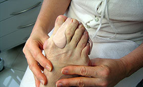 Hallux Valgus Orthose am Fuß