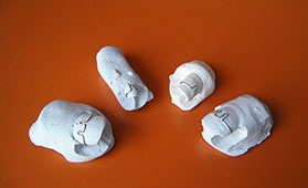 Nagelkorrekturspange bei eingewachsenem Nagel